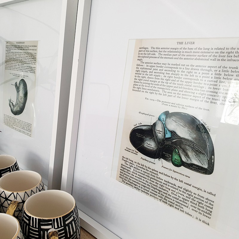 DECOR: Cape Gastro 